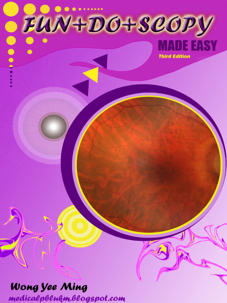 Fundoscopy Basics for Medical Students | PDF | Retina | Human Eye