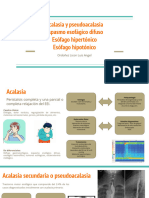 Acalasia y Pseudoacalasia Espasmo Esofágico Difuso Esófago Hipertónico Esófago Hipotónico