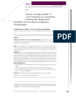 The Maintenance of Pulp Health 17 Years After Root Fracture in A Maxillary Incisor Illustrating The Diagnostic Benefits of Cone Bean Computed Tomography