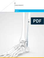 Acumed ES Surgical Technique Fibula Nail 2 ESFNA10 02 A