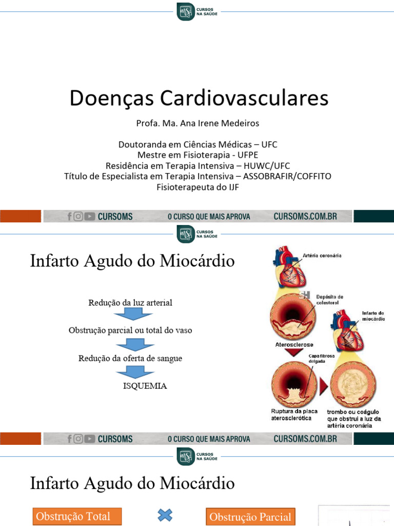 Doenças Cardiovasculares: Tipos e Sintomas | PDF | Coração | Infarto do ...