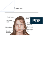 Williams Syndrome