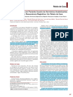 Miocardite Aguda em Paciente Usuário de Hormônios Anabolizantes Diagnosticada Por Ressonância Magnética: Um Relato de Caso