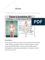 Turner Syndrome: Description