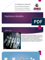 Implantes Dentales André Torres Mendoza 2023