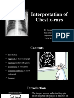 Chest X Ray Session