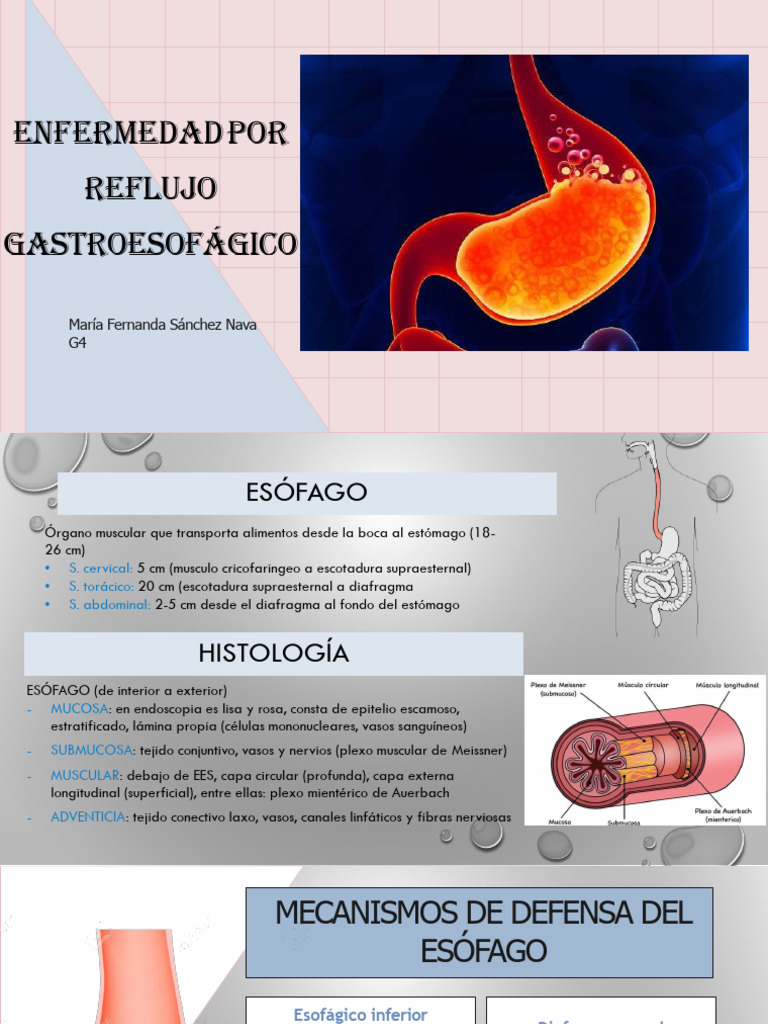Enfermedad por Reflujo Gastroesofágico | PDF | Esófago | Estómago