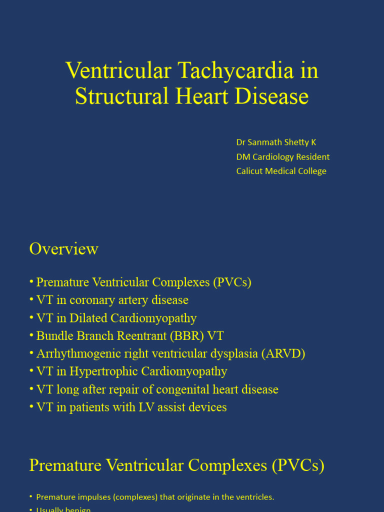 Ventricular Tachycardia in Heart Disease | PDF | Electrocardiography ...
