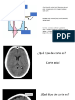 Estudio Neuroanatomía 1