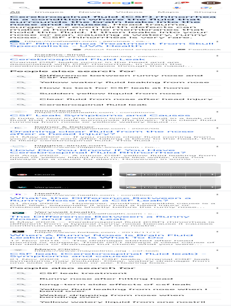 Yellow Fluid Coming Out of Nose After Head Injury Google Search PDF