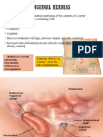 INGUINAL HERNIAS - Short Surgery Presentation