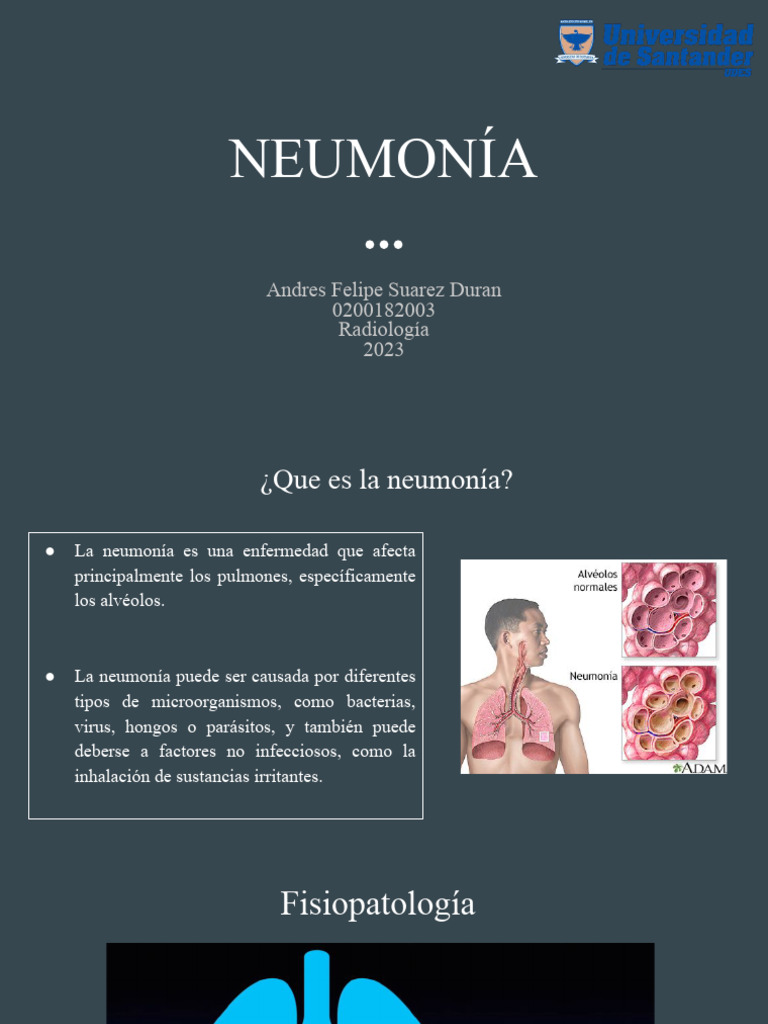Tipos y Tratamiento de Neumonía | PDF | Neumonía | Medicina