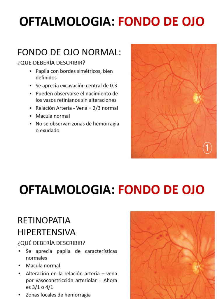 descripci-n-del-fondo-de-ojo-normal-y-anormal-pdf