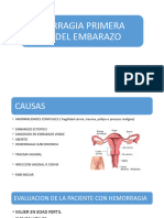 Aborto Ectopico Mola