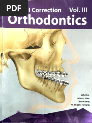 Class III Correction Vol III Orthodontics John Lin, Chris Chang | PDF