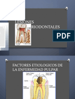 Lesiones Endoperiodontales