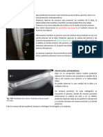 Tibia y Peroné