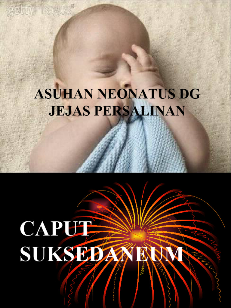 Jejas Persalinan pada Neonatus | PDF