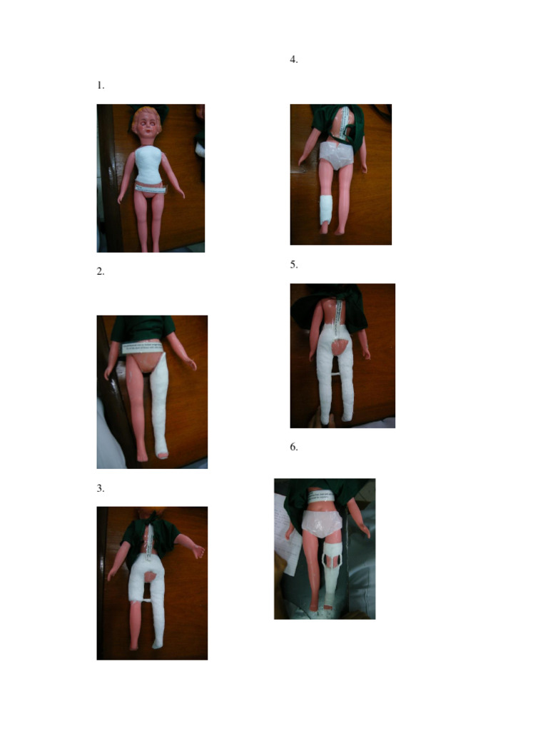 CASTS | PDF | Knee | Hip