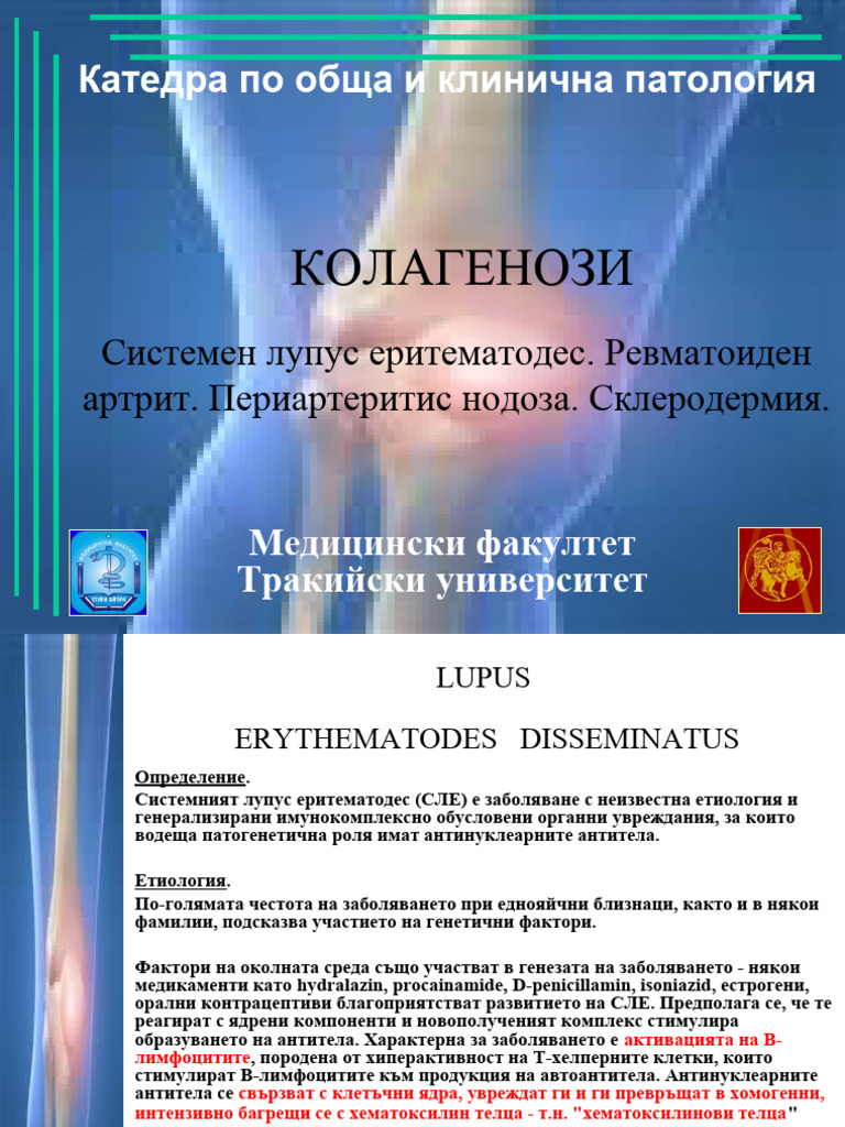 Kolagenozi, Reumatism | PDF