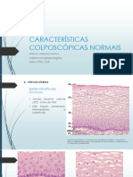 1 Achados Colposcópicos Normais