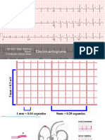 Electrocardiograma