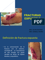 Fracturas - Expuestas, D, K