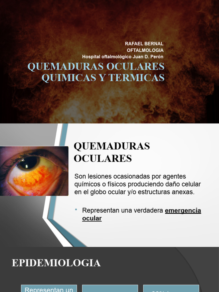 Manejo de Quemaduras Oculares | PDF | Quemar | Córnea