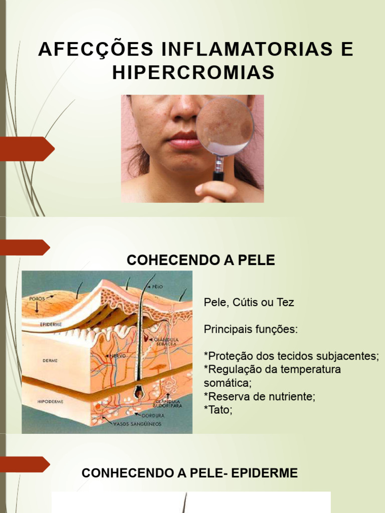 Afecções Inflamatórias e Hipercrômicas da Pele | PDF | Pele | Epiderme