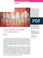 Prótesis Dentales Removibles