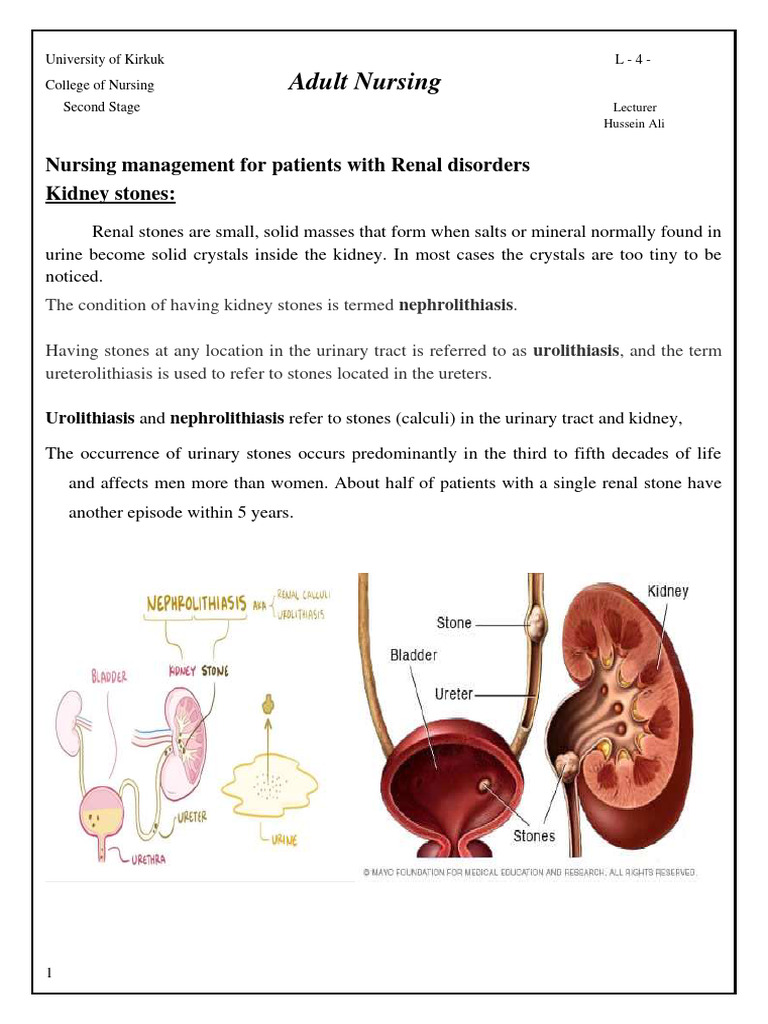 Kidney Stones: Management and Treatment | PDF | Chronic Kidney Disease ...