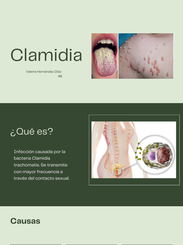 Clamidia: Causas y Síntomas | PDF | Causas de la muerte | Medicina CLINICA