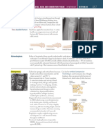 Bone Diseases Lec 1