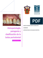 Histopatología, Patogenia y Clasificación de La Bolsa Periodontal - GRSG