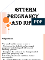 Postterm Pregnancy and IUFD