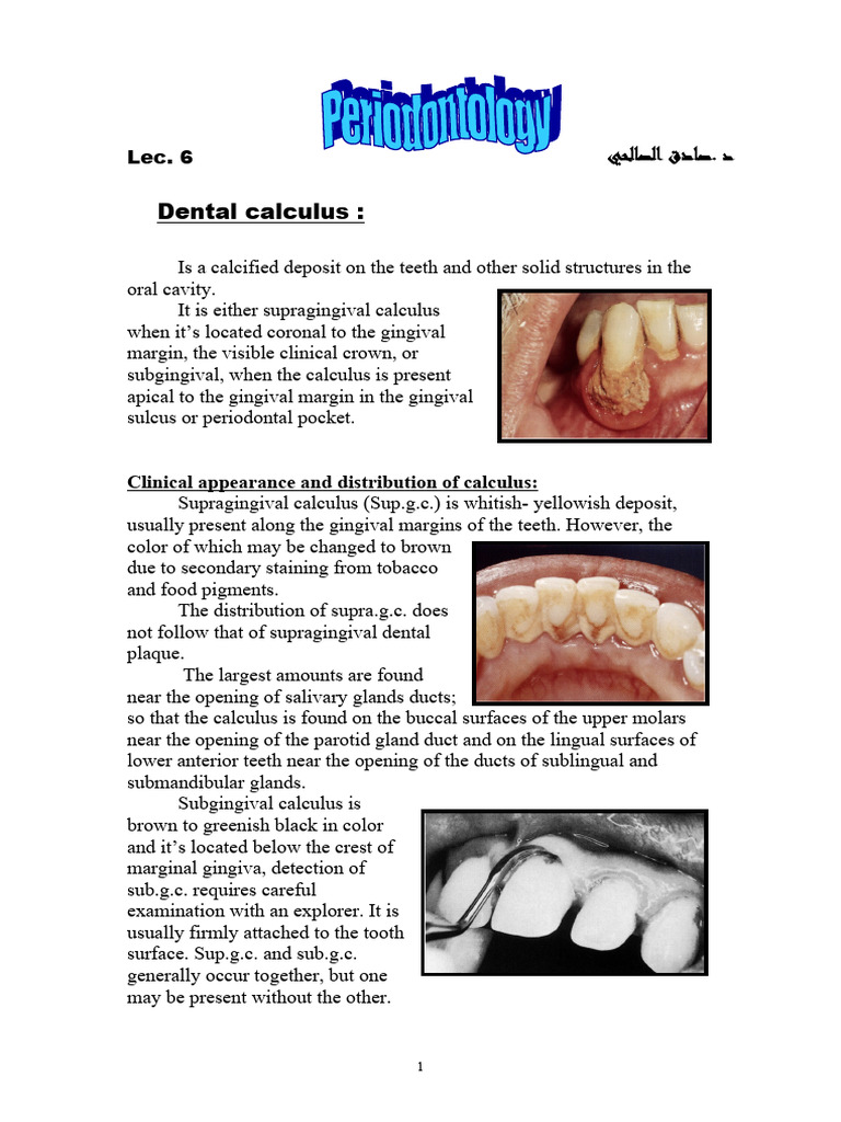 Dental Calculus | Download Free PDF | Mouth