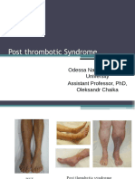 +oleksandr Chaika Theme 17 Postthrombophlebetic Syndrome.