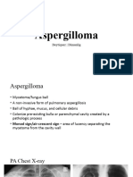 Aspergilloma