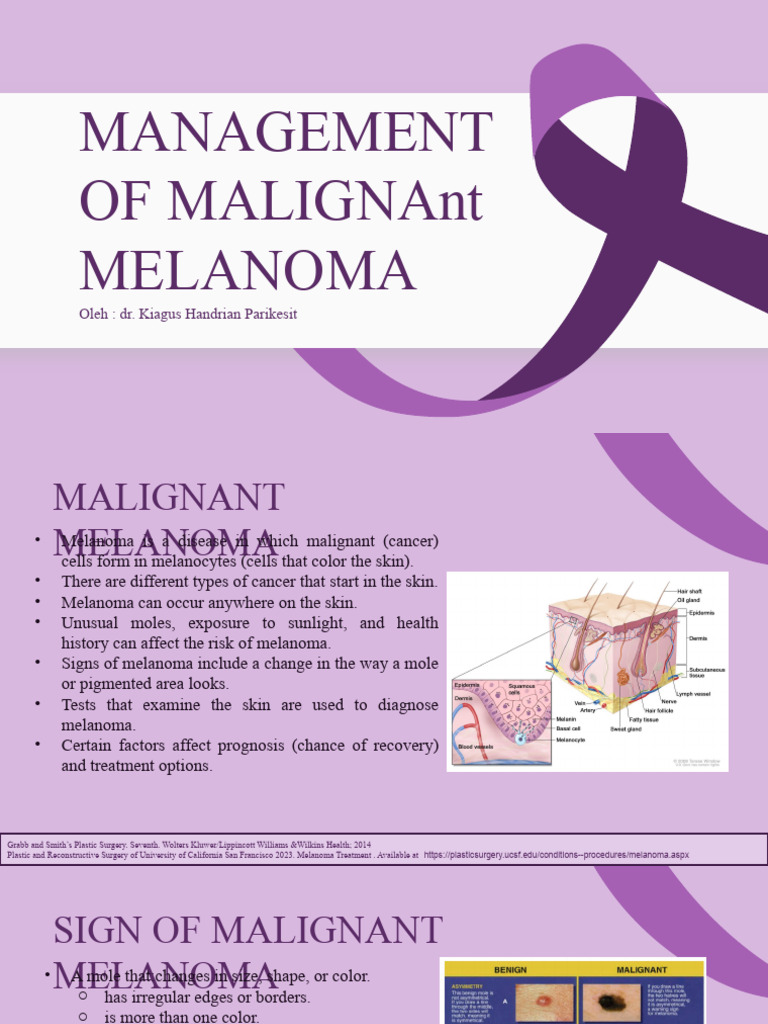 Management of Malignant Melanoma DR Kiagus Handrian Parikersit | PDF ...