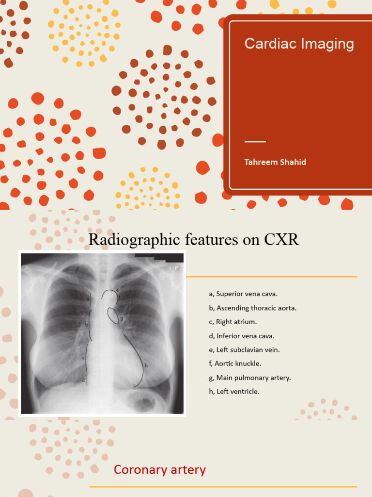 Cardiac Imaging Techniques and Findings | PDF | Coronary Circulation ...