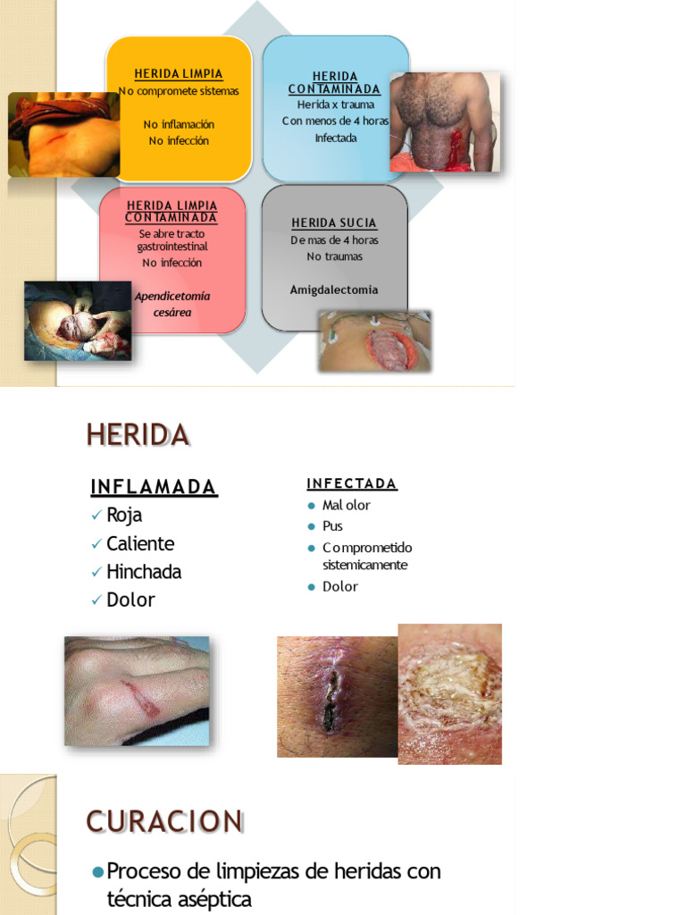 Clasificacin de Heridas: Limpias y Contaminadas | PDF