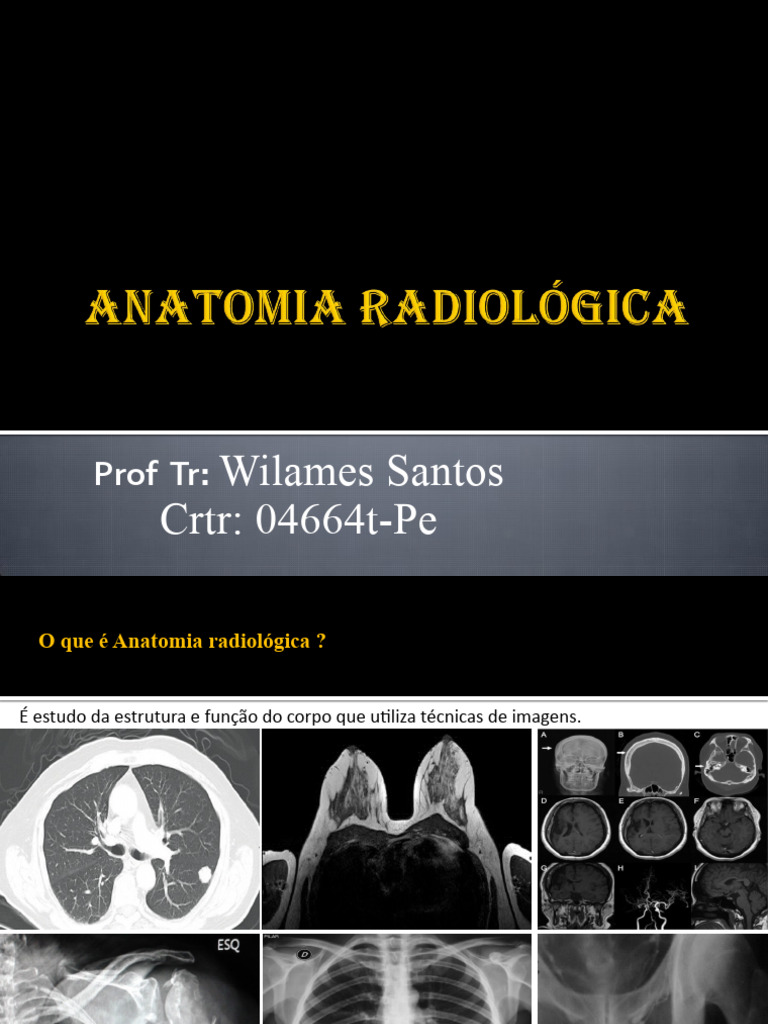 Protocolos em Ressonamcia Magnetica - Completo | PDF | AVC | Coração, image size:768x1024