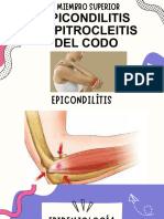 Epicondilitis y Epitrocleitis