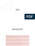ECG Problems