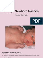 Newborn Rash