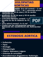 Valvulopatias Aorticas