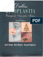 DALLAS - Rinoplastia - Cirurgia de Nariz Pelos Mestres