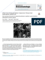 A Rare Cause of Lung and Splenic Compression - 2021 - Archivos de Bronconeumol