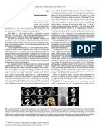 Bronchial Artery Pseudoaneurysm and Mediast - 2021 - Archivos de Bronconeumolog