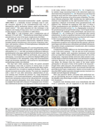 Bronchial Artery Pseudoaneurysm and Mediast - 2021 - Archivos de Bronconeumolog